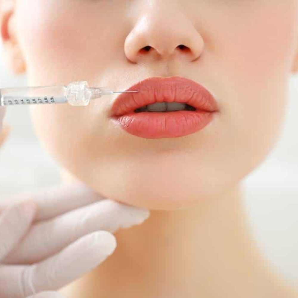 are-dermal-fillers-considered-plastic-surgery